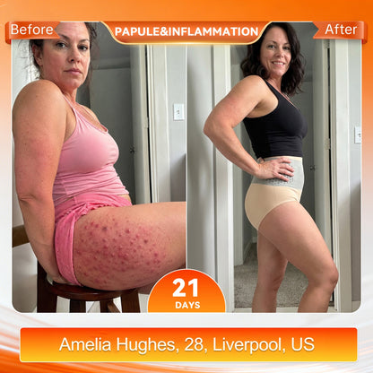 🎁 Only 5 boxes left! We're offering you an additional 80% discount! Get yourself in shape and healthy. Miss out now, and you won't have another chance until next year.