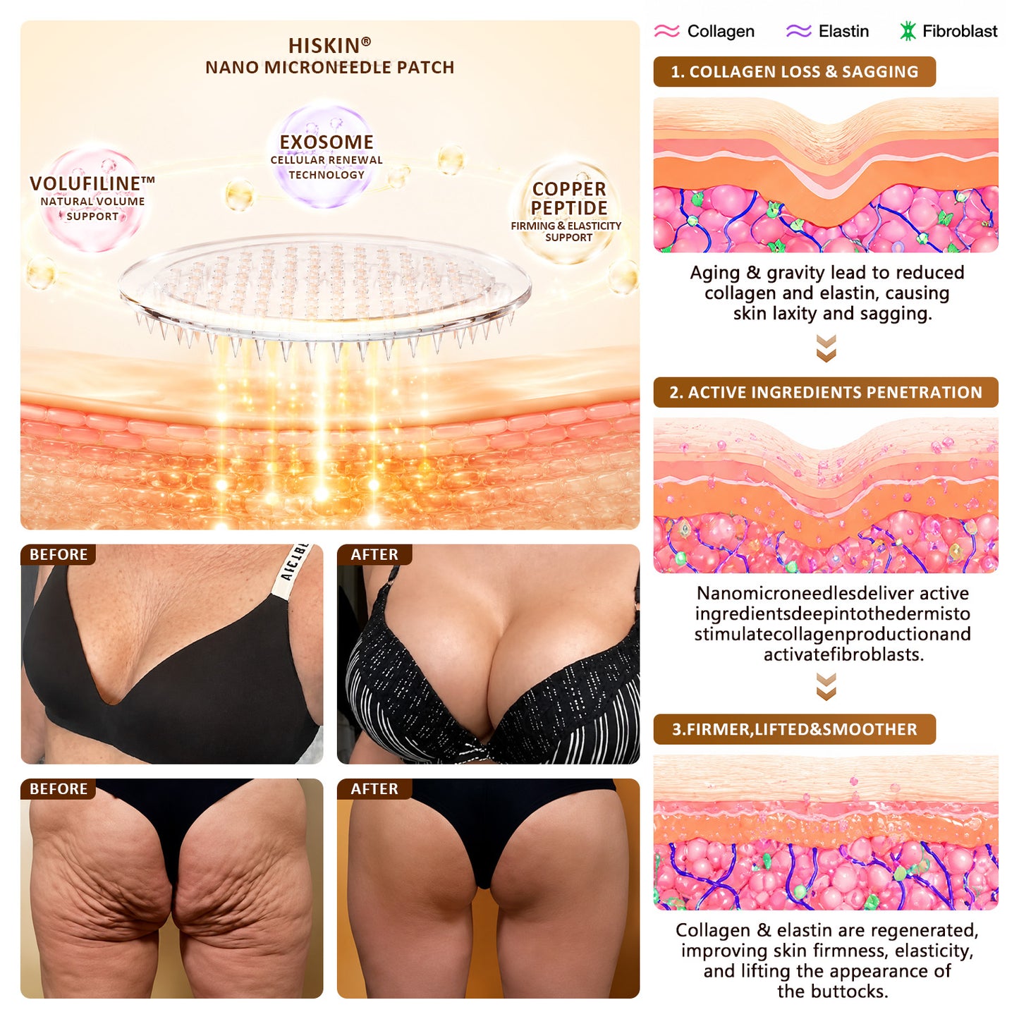 HISKIN® Bust Volume, Lift & Firming Nano Microneedle Patch Astaxanthin + Volufiline + Exosome + Copper Peptide Formula Powered by Cellular Renewal Technology💎