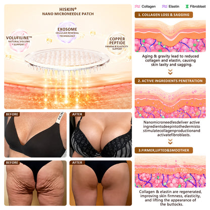 HISKIN® Bust Volume, Lift & Firming Nano Microneedle Patch Astaxanthin + Volufiline + Exosome + Copper Peptide Formula Powered by Cellular Renewal Technology💎