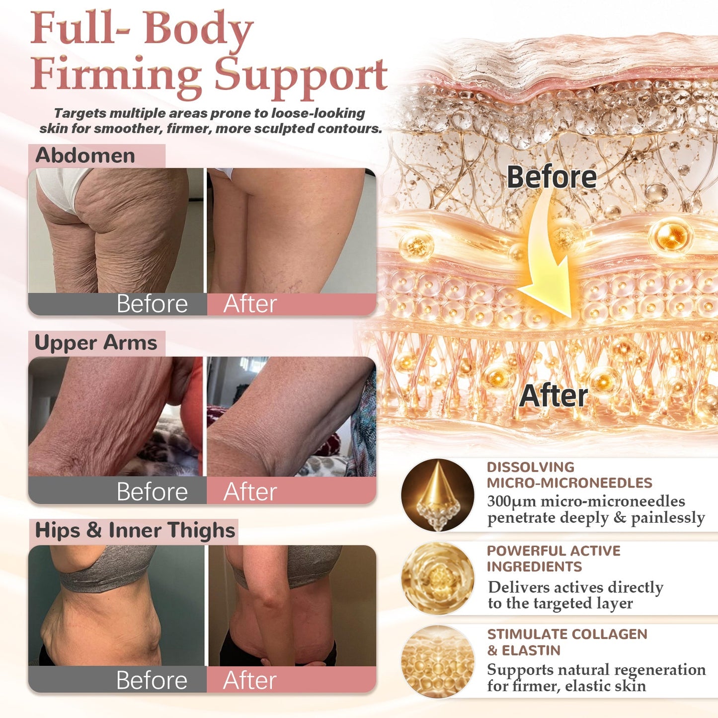 HISKIN® BREAST ENHANCEMENT  LIFT & FIRM MICRONEEDLE PATCHES