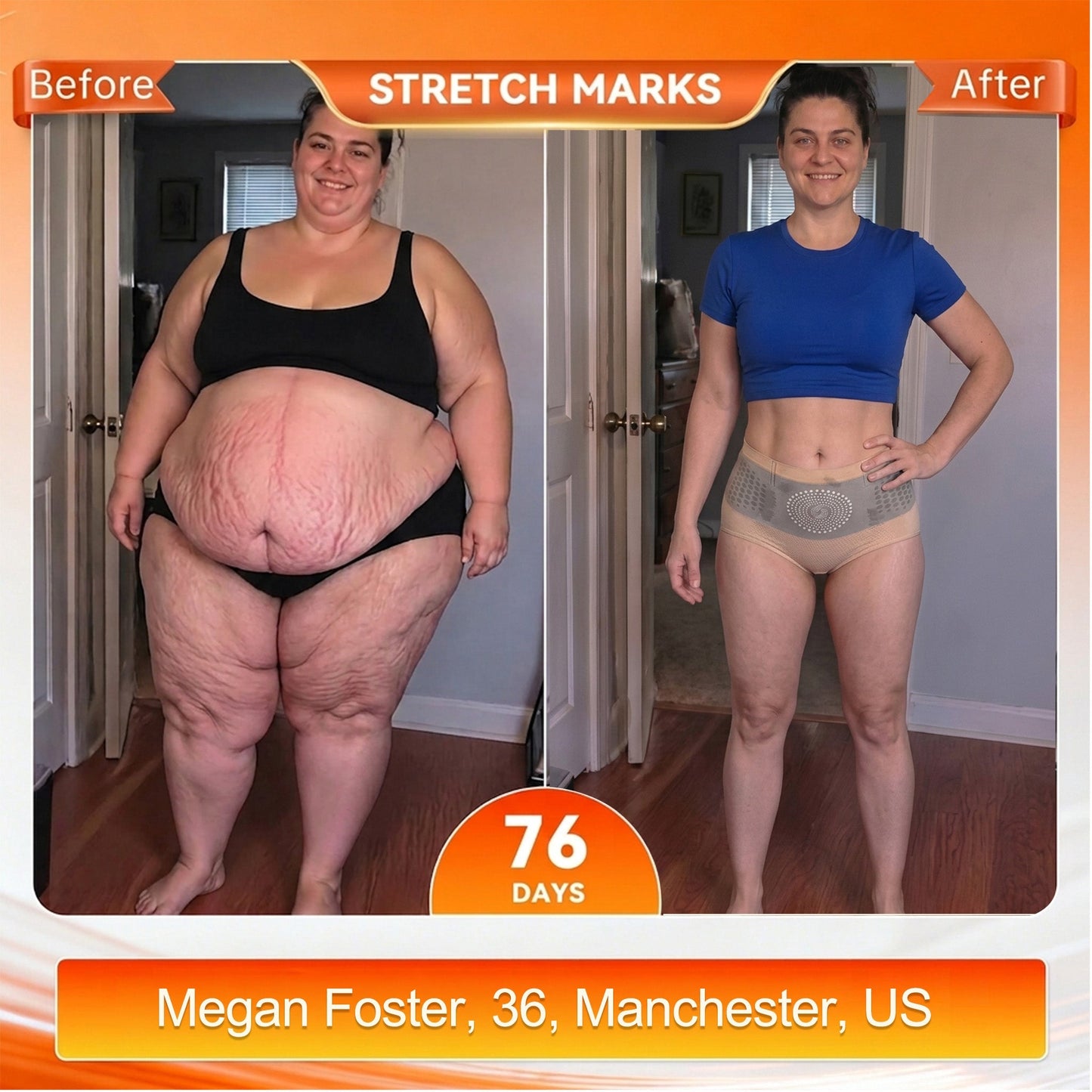 🎁 Only 5 boxes left! We're offering you an additional 80% discount! Get yourself in shape and healthy. Miss out now, and you won't have another chance until next year.